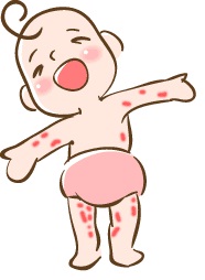 소아기 유아기 아토피성 피부염, 치료 소홀하면 '성인 아토피'