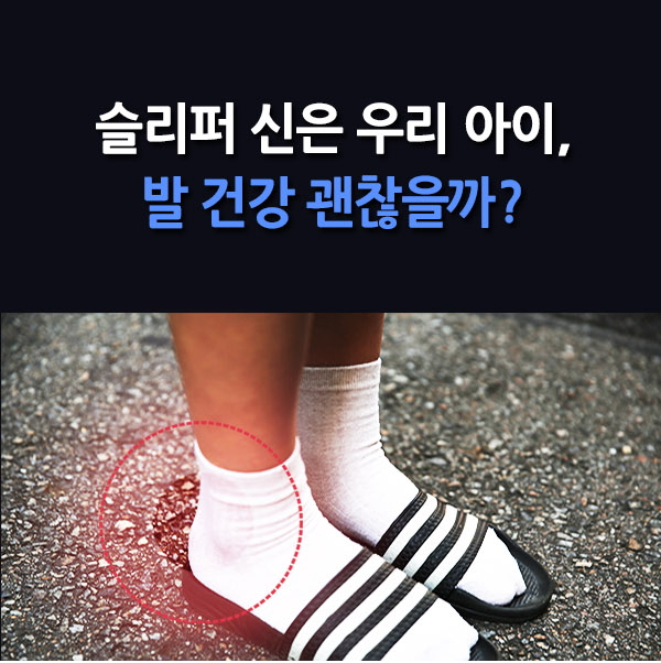 [조선에듀][카드뉴스] 슬리퍼 신은 우리 아이, 발 건강 괜찮을까?